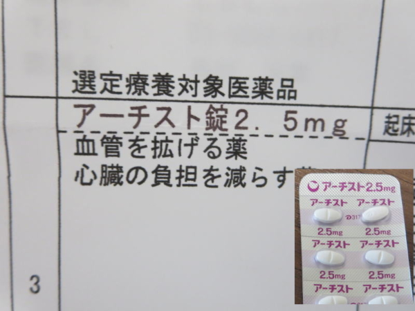 選定療養対象医薬品、アーチスト錠