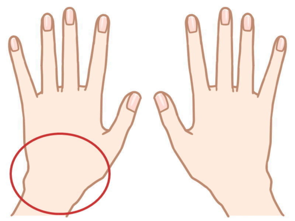 左手、特に手首が痛い