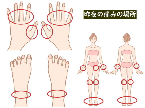 昨夜の痛みの場所