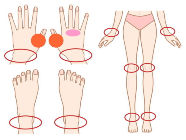 今朝のリウマチの症状の出ている場所(関節リウマチ治療754日目)